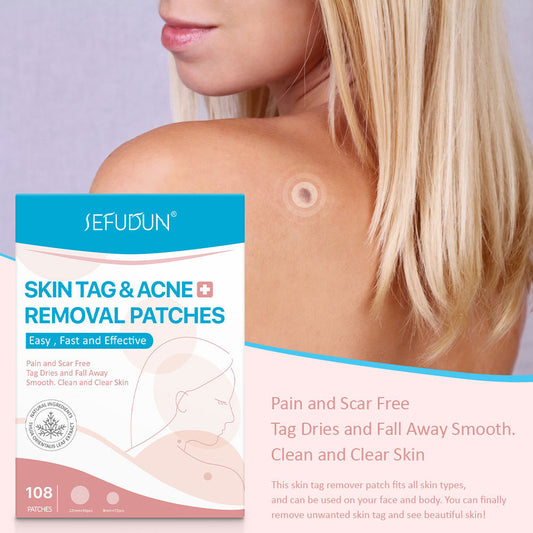 Skin Tag & Acne Removal Patches – 108 Stickers for Clear & Smooth Skin