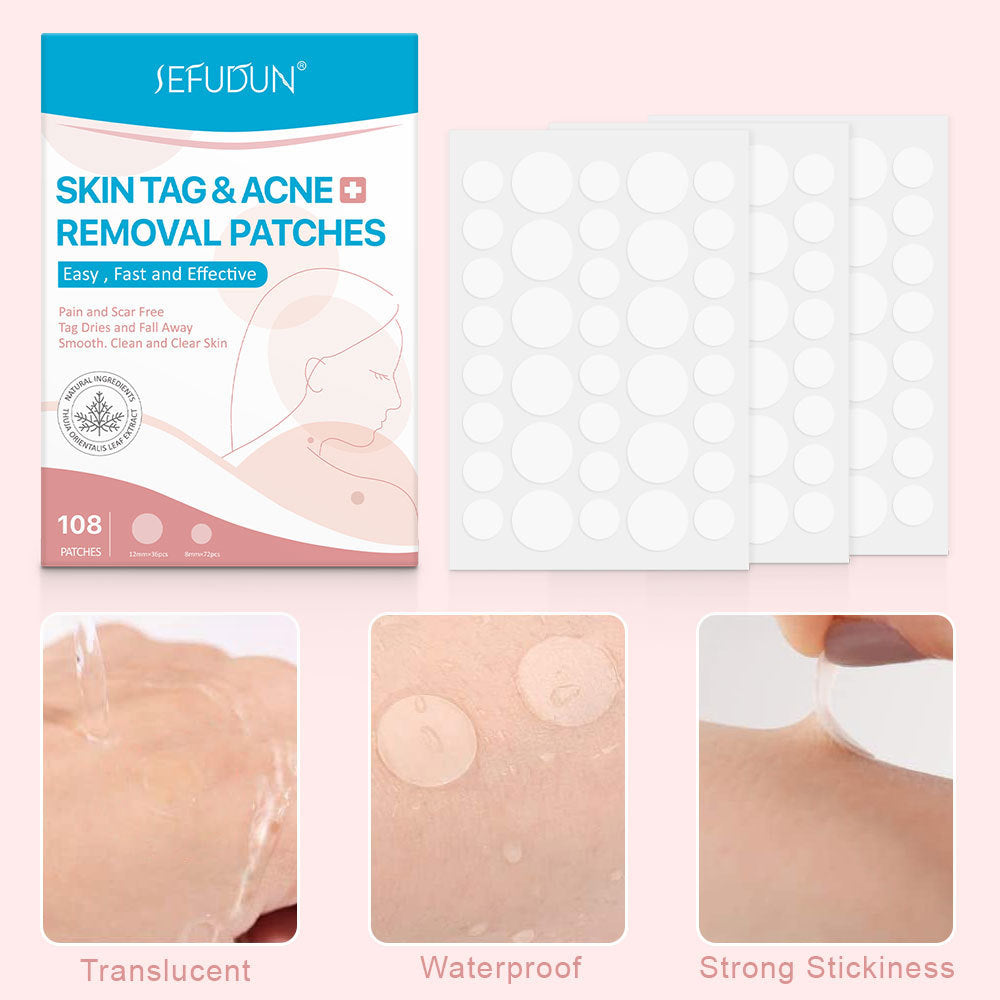 Skin Tag & Acne Removal Patches – 108 Stickers for Clear & Smooth Skin