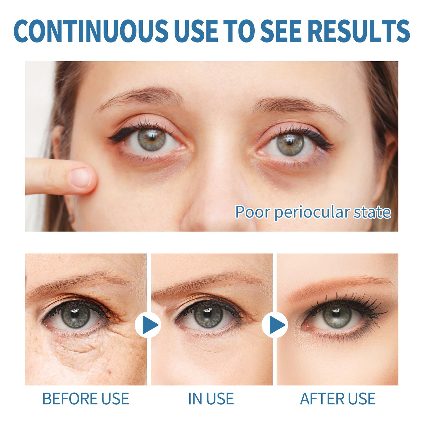 Marine Collagen Eye Gel Patches – 12 Pairs for Puffy Eyes & Dark Circles